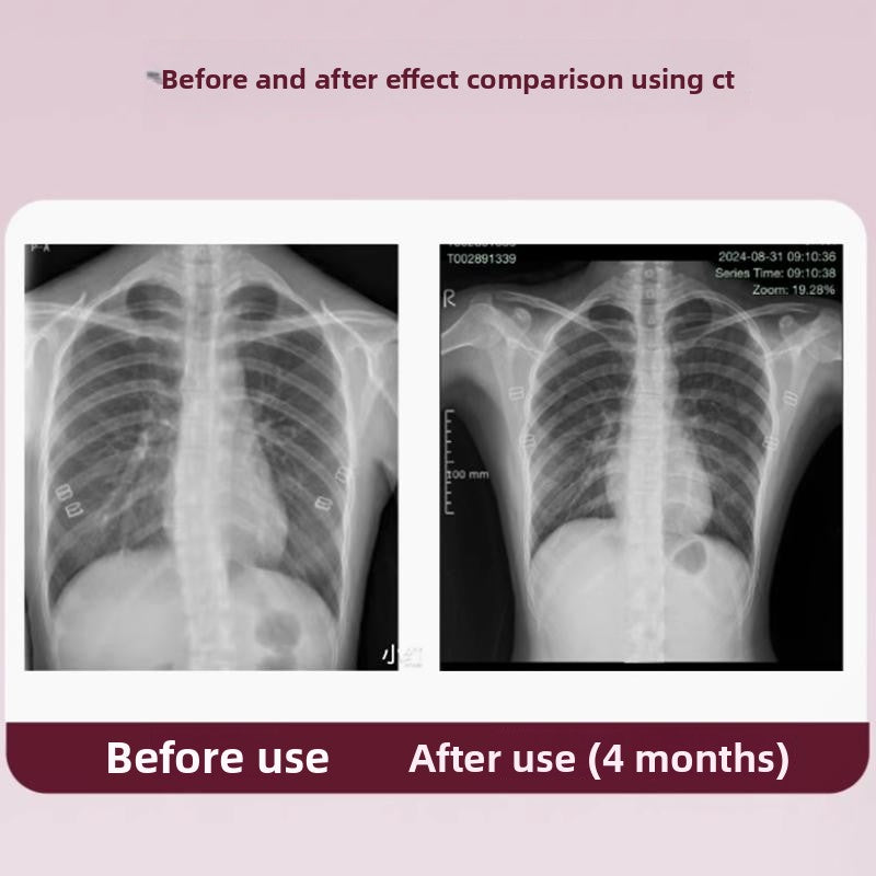 Posture Correction Pillow